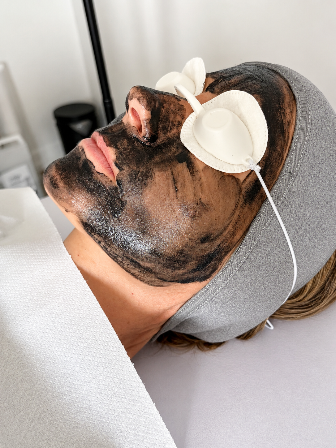 Carbon Laser Facial treatment result